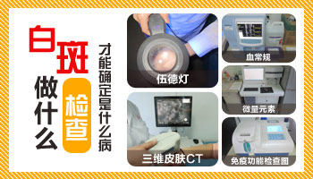 白癜风低龄化的症状
